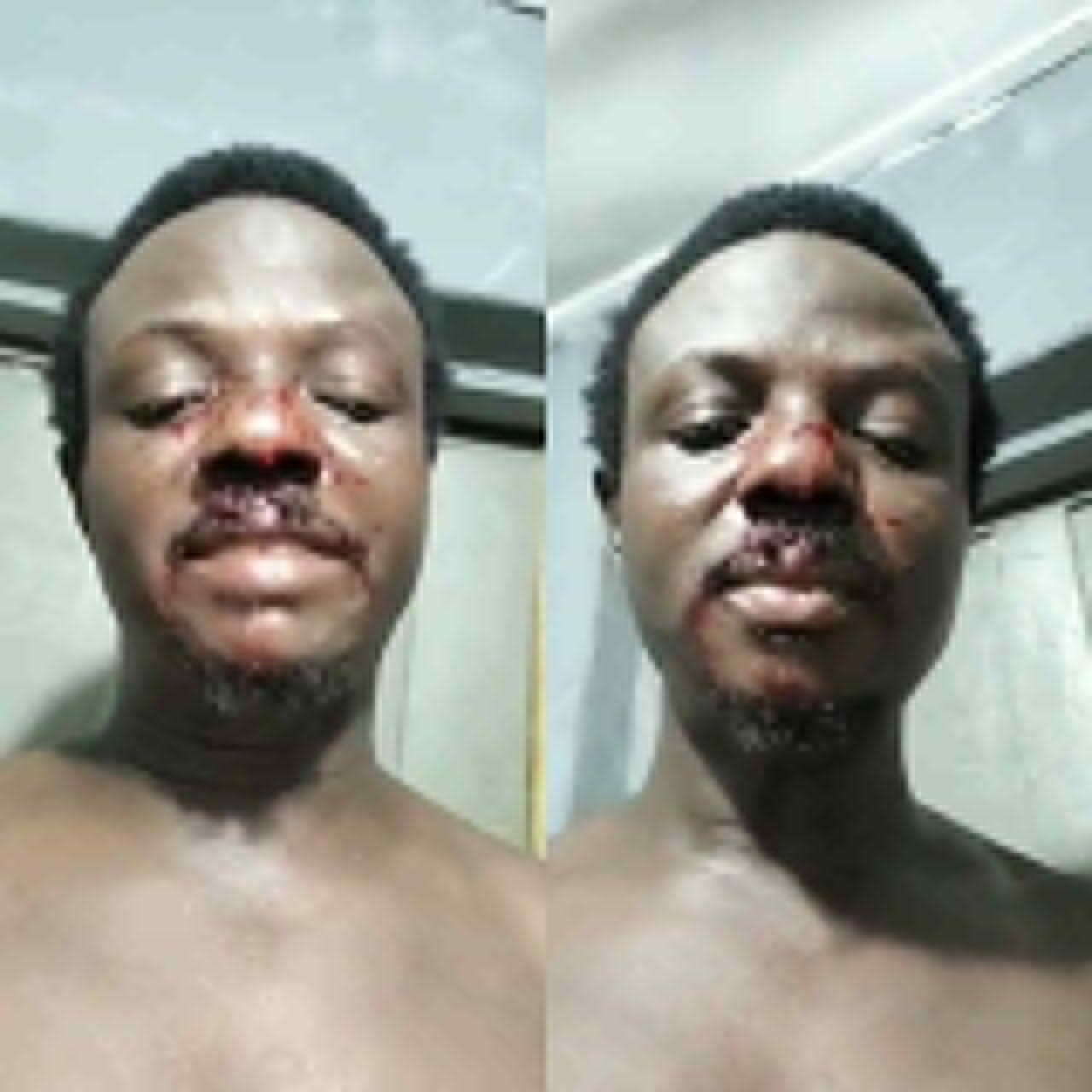 After boarding a commercial bus at the Lekki-Ikoyi link Bridge in Lagos, a man reveals harrowing details of how he was kidnapped and nearly killed by suspected kidnappers (video)